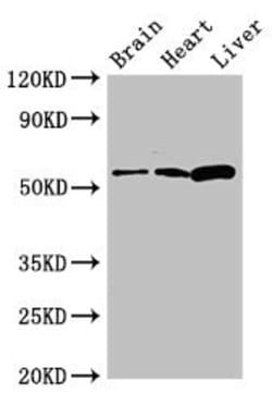 Invitrogen CPEB2 Polyclonal Antibody 100 &mu;g; Unconjugated:Antibodies,
