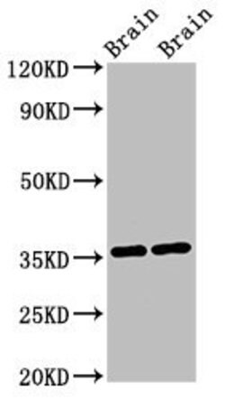 Invitrogen NIT1 Polyclonal Antibody 100 &mu;g; Unconjugated:Antibodies,