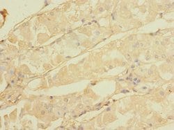 Invitrogen CALHM3 Polyclonal Antibody 100 &mu;g | Buy Online | Invitrogen&trade; | Fisher Scientific