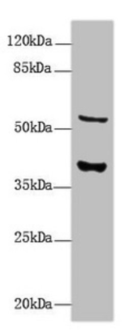 Invitrogen CALHM3 Polyclonal Antibody 100 &mu;g | Buy Online | Invitrogen&trade; | Fisher Scientific