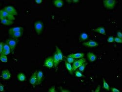 Invitrogen SLC13A5 Polyclonal Antibody 100 &mu;g; Unconjugated:Antibodies,