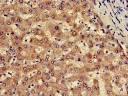 Invitrogen SLC13A5 Polyclonal Antibody 100 &mu;g; Unconjugated:Antibodies,