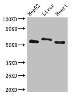 Invitrogen SLC13A5 Polyclonal Antibody 100 &mu;g; Unconjugated:Antibodies,