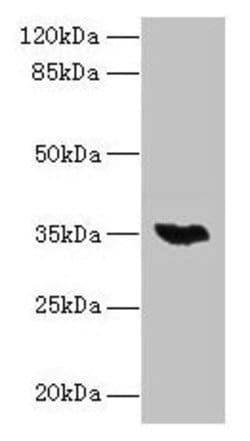 Invitrogen LYSMD3 Polyclonal Antibody 100 &mu;g; Unconjugated:Antibodies,