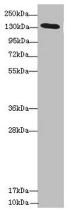 Invitrogen NPHP3 Polyclonal Antibody 100 &mu;L; Unconjugated:Antibodies,