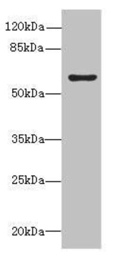 Invitrogen KIAA0907 Polyclonal Antibody 100 &mu;g | Buy Online | Invitrogen&trade; | Fisher Scientific