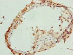 Invitrogen C17orf64 Polyclonal Antibody 100 μg; Unconjugated:Antibodies,