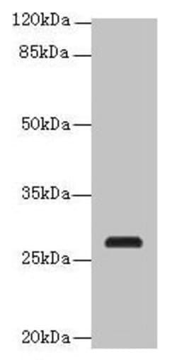Invitrogen C17orf64 Polyclonal Antibody 100 μg; Unconjugated:Antibodies,