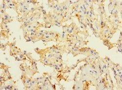 Invitrogen CIR1 Polyclonal Antibody 100 μL; Unconjugated:Antibodies,