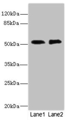 Invitrogen CIR1 Polyclonal Antibody 100 μL; Unconjugated:Antibodies,