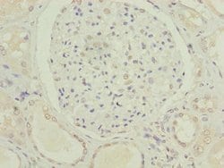 Invitrogen C5orf24 Polyclonal Antibody 100 μg; Unconjugated:Antibodies,