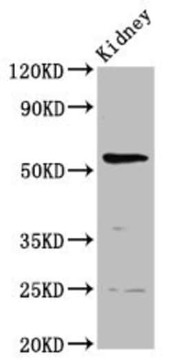 Invitrogen PIGW Polyclonal Antibody 100 &mu;g; Unconjugated:Antibodies,