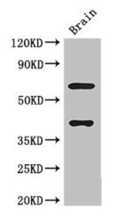Invitrogen LRRTM4 Polyclonal Antibody 100 &mu;g; Unconjugated:Antibodies,
