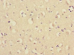 RNF36 Polyclonal Antibody:Antibodies, Polyclonal