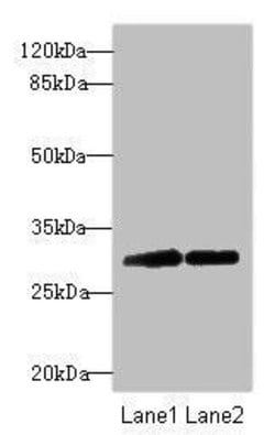 RNF36 Polyclonal Antibody:Antibodies, Polyclonal