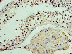 Invitrogen MON1A Polyclonal Antibody 100 &mu;g; Unconjugated:Antibodies,