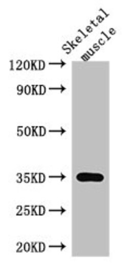 Invitrogen ANKRD23 Polyclonal Antibody 100 &mu;g; Unconjugated:Antibodies,