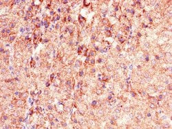 Invitrogen PHLDB2 Polyclonal Antibody 100 &mu;g | Buy Online | Invitrogen&trade; | Fisher Scientific