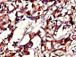 Invitrogen PHLDB2 Polyclonal Antibody 100 &mu;g | Buy Online | Invitrogen&trade; | Fisher Scientific