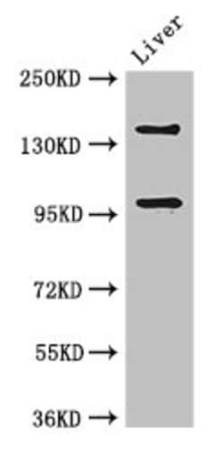 Invitrogen PHLDB2 Polyclonal Antibody 100 &mu;g | Buy Online | Invitrogen&trade; | Fisher Scientific