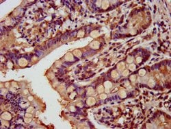Invitrogen GATAD2A Polyclonal Antibody 100 &mu;g; Unconjugated:Antibodies,
