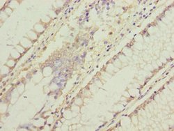 Invitrogen C11orf53 Polyclonal Antibody 100 μg; Unconjugated:Antibodies,