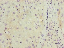 Invitrogen C11orf53 Polyclonal Antibody 100 μg; Unconjugated:Antibodies,