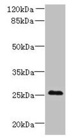 Invitrogen C11orf53 Polyclonal Antibody 100 μg; Unconjugated:Antibodies,