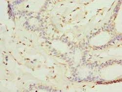 Invitrogen KATNAL2 Polyclonal Antibody 100 μg; Unconjugated:Antibodies,
