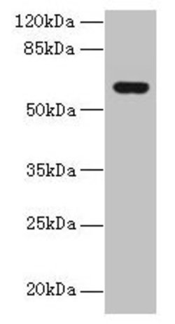 Invitrogen KATNAL2 Polyclonal Antibody 100 μg; Unconjugated:Antibodies,