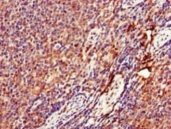 Invitrogen DENND1C Polyclonal Antibody 100 &mu;g | Buy Online | Invitrogen&trade; | Fisher Scientific