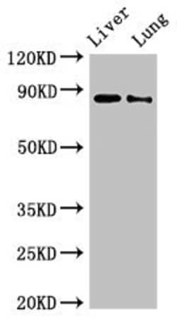 Invitrogen DENND1C Polyclonal Antibody 100 &mu;g | Buy Online | Invitrogen&trade; | Fisher Scientific