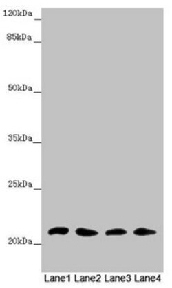 Invitrogen MSRB3 Polyclonal Antibody 100 &mu;L; Unconjugated:Antibodies,