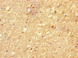 Invitrogen NIM1 Polyclonal Antibody 100 &mu;g; Unconjugated:Antibodies,
