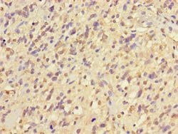 Invitrogen NIM1 Polyclonal Antibody 100 &mu;g; Unconjugated:Antibodies,