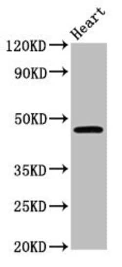Invitrogen Lass3 Polyclonal Antibody 100 μg; Unconjugated:Antibodies,