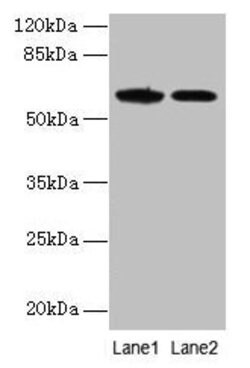 Invitrogen EGFL6 Polyclonal Antibody 100 &mu;g; Unconjugated:Antibodies,