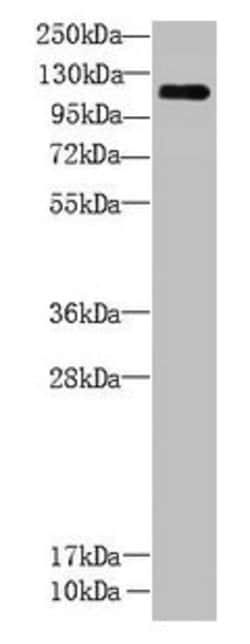 Invitrogen CCDC103 Polyclonal Antibody 100 &mu;g; Unconjugated:Antibodies,