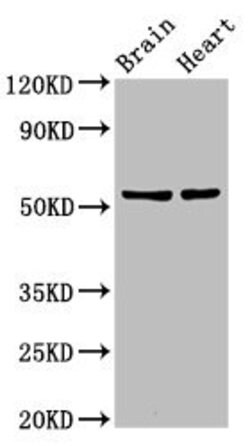 Invitrogen DRB1 Polyclonal Antibody 100 μg; Unconjugated:Antibodies,