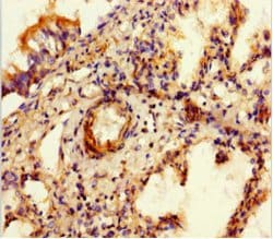 Invitrogen SULF1 Polyclonal Antibody 100 μg; Unconjugated:Antibodies,