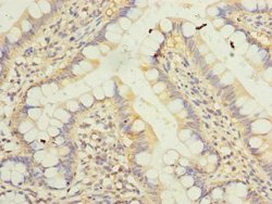 Invitrogen KLHDC8A Polyclonal Antibody 100 μg; Unconjugated:Antibodies,