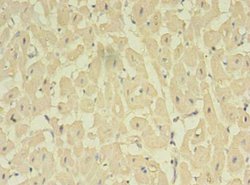 Invitrogen NOSTRIN Polyclonal Antibody 100 &mu;g | Buy Online | Invitrogen&trade; | Fisher Scientific