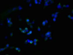 Invitrogen ZDHHC23 Polyclonal Antibody 100 &mu;g; Unconjugated:Antibodies,