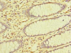 Invitrogen ZDHHC23 Polyclonal Antibody 100 &mu;g; Unconjugated:Antibodies,