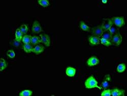 Invitrogen SLC38A6 Polyclonal Antibody 100 μg; Unconjugated:Antibodies,