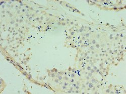 Invitrogen SPAG16 Polyclonal Antibody 100 &mu;L; Unconjugated:Antibodies,