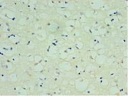Invitrogen SPAG16 Polyclonal Antibody 100 &mu;L; Unconjugated:Antibodies,
