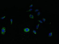 Invitrogen SVOPL Polyclonal Antibody 100 μg; Unconjugated:Antibodies,