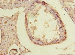 TTC30B Polyclonal Antibody:Antibodies, Polyclonal