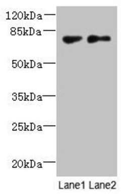 TTC30B Polyclonal Antibody:Antibodies, Polyclonal